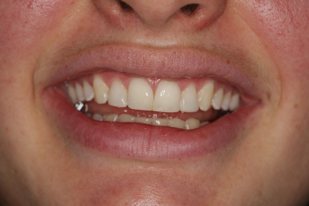 Dentist Boulder CO