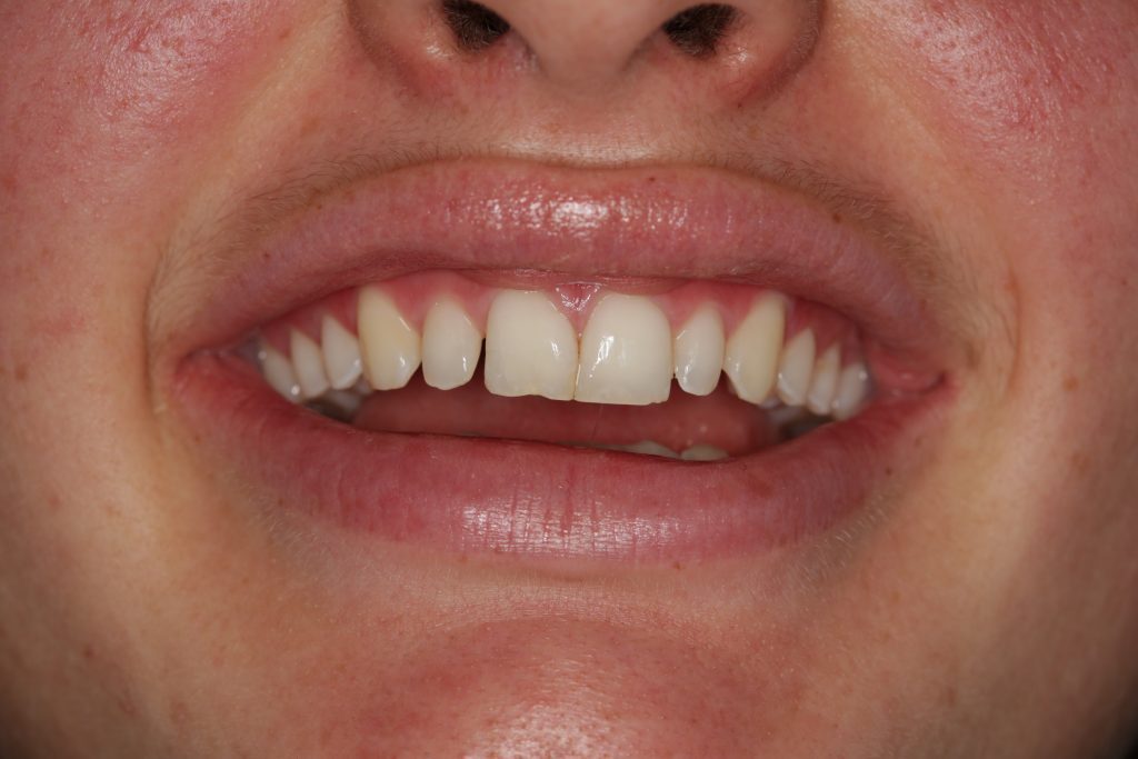 Dentist Boulder CO
