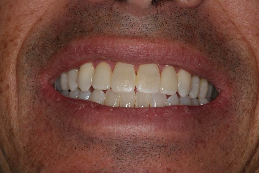 Dentist Boulder CO