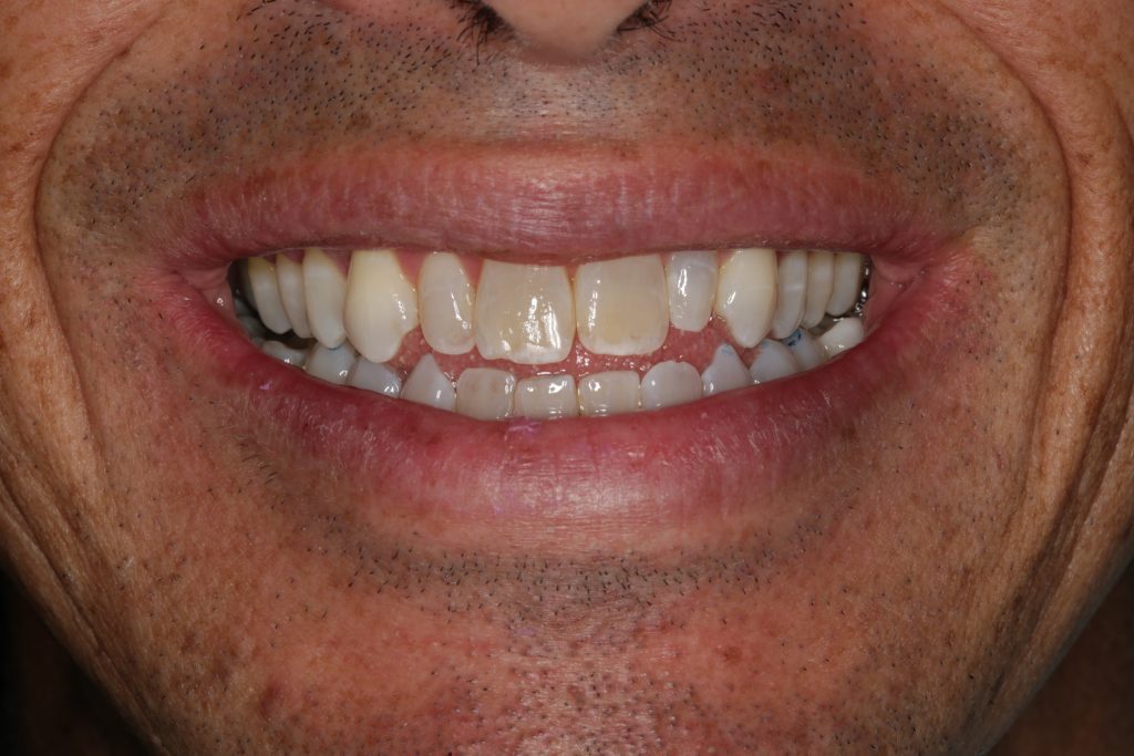 Dentist Boulder CO