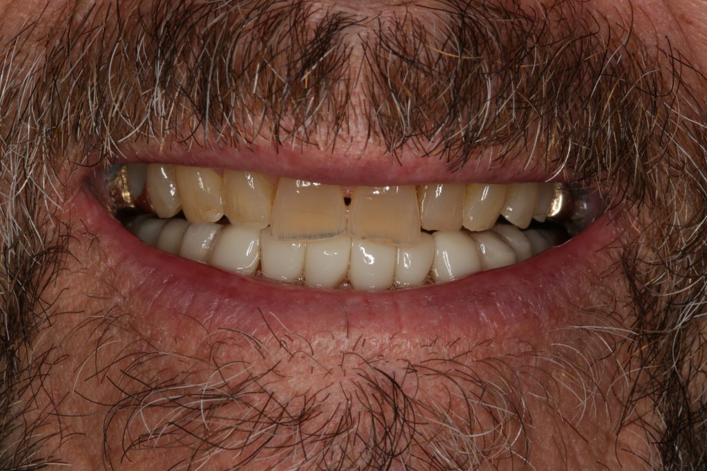 Dentist Boulder CO
