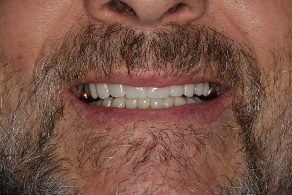 Dentist Boulder CO