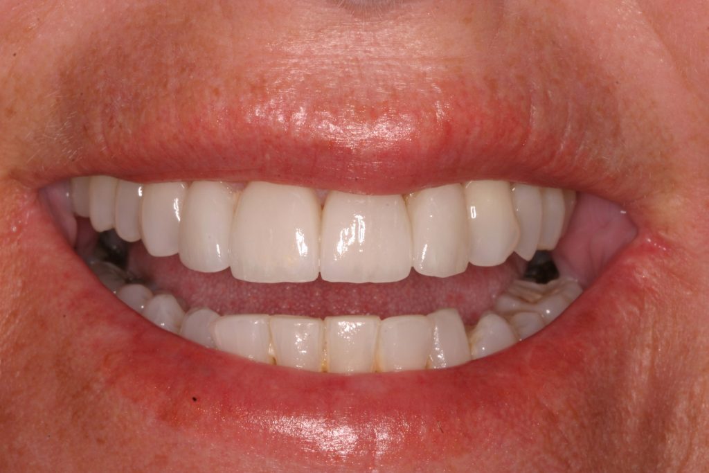 Dentist Boulder CO