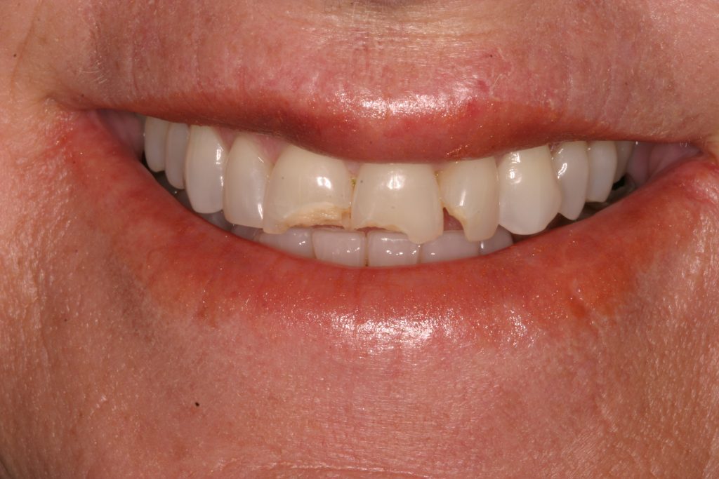 Dentist Boulder CO