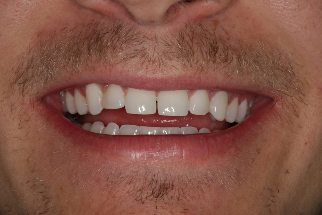 Dentist Boulder CO