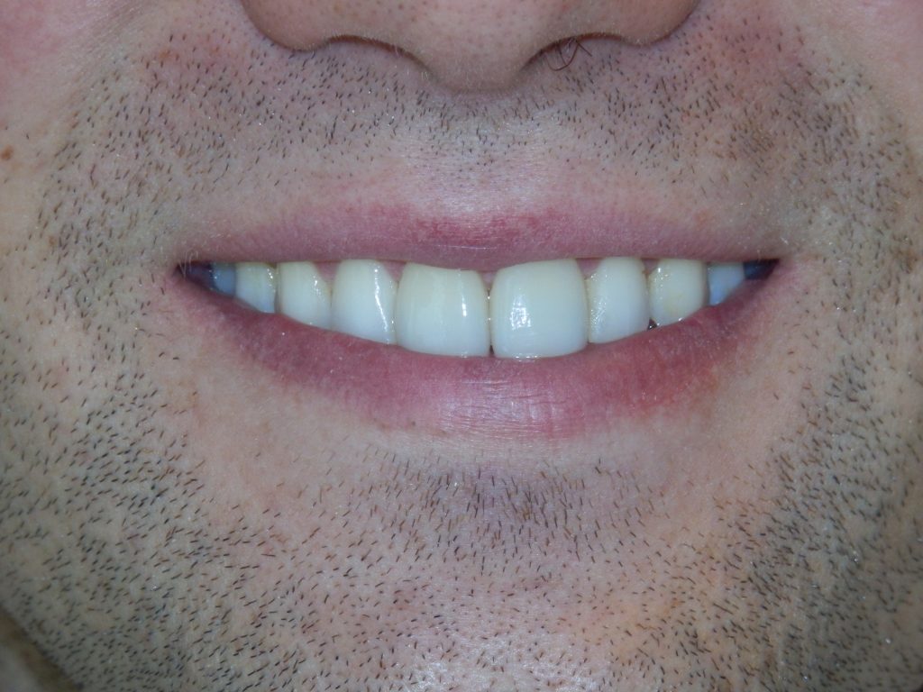 Dentist Boulder CO
