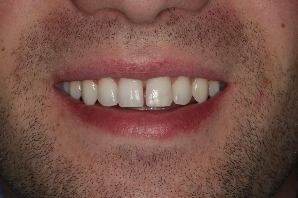 Dentist Boulder CO