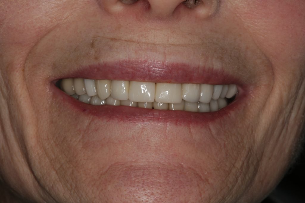 Dentist Boulder CO