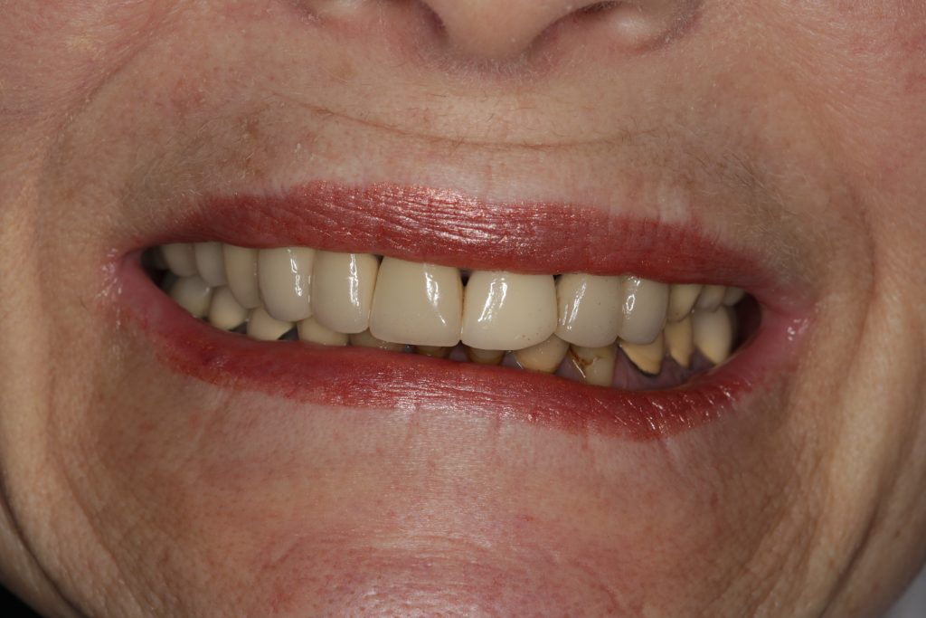 Dentist Boulder CO