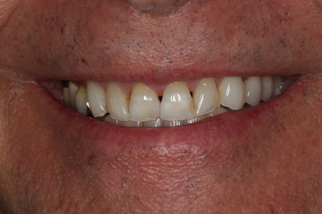 Dentist Boulder CO