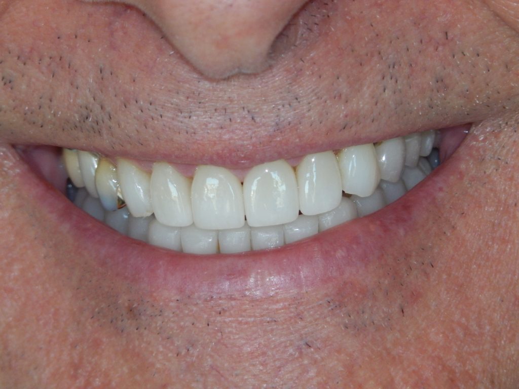 Dentist Boulder CO