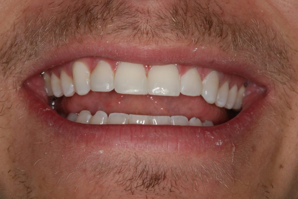 Dentist Boulder CO