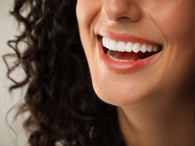 Planning Your Complete Smile Makeover Journey